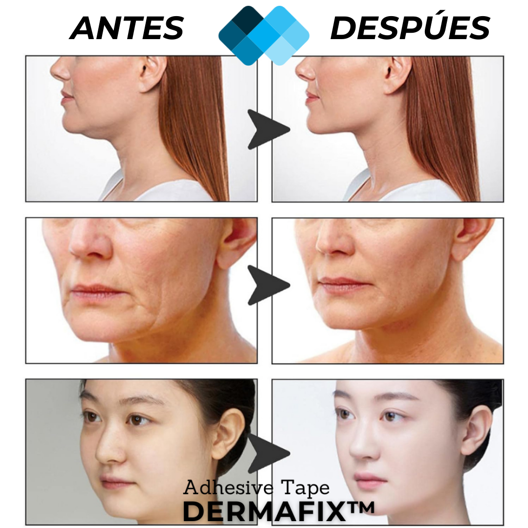 Marn - Tiras de Lifting Facial Anti-edad (60 Unidades x Pack)